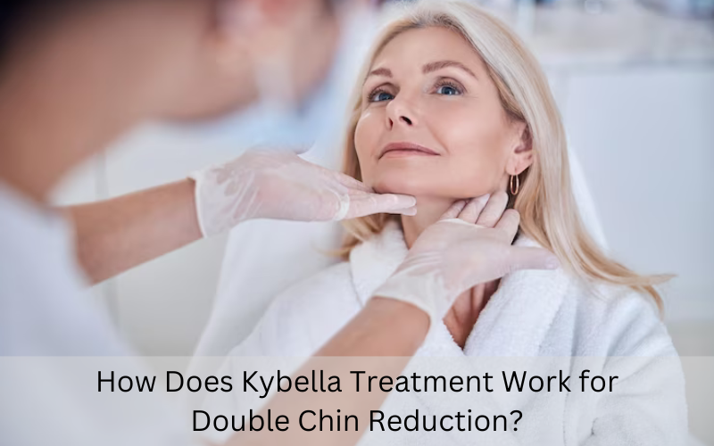 Kybella treatment for double chin