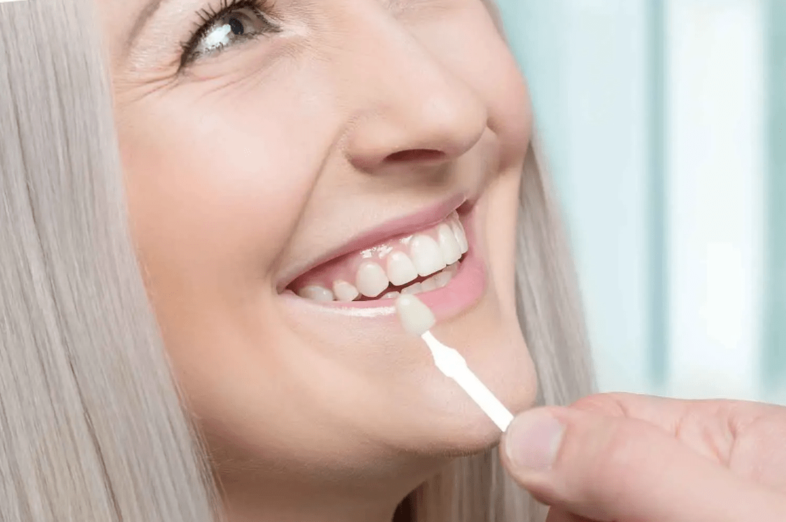 Best Cosmetic Dentist in Baton Rouge