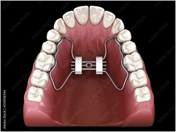 quad helix