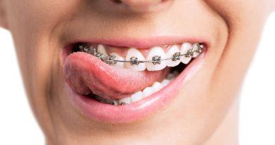 orthodontist Oak Park CA