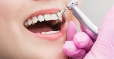 dental cleaning in toronto