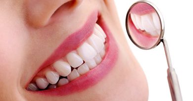 how long does teeth whitening last
