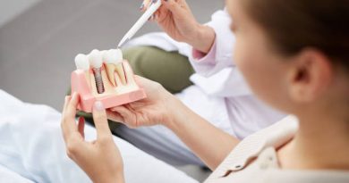 post-op dental implant care guide
