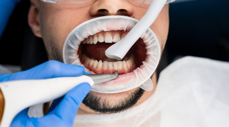 what to expect during a simple tooth removal procedure