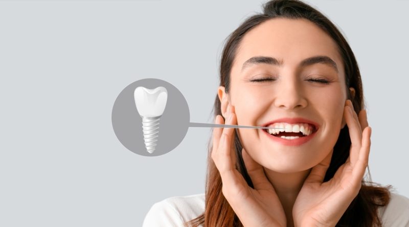 how dental implants replace missing teeth and improve everyday function